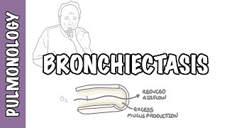 Bronchiectasis  causes pathophysiology signs and symptoms investigations and treatment [upl. by Levitus62]