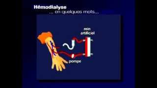 comment ça marche lhémodialyse [upl. by Kifar]