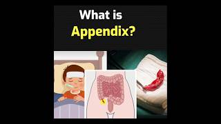 Is your Appendix Useless scienceshortsBodyAnatomydidyouknowshortsfeedshortsvideoviralvideo [upl. by Cuthburt985]