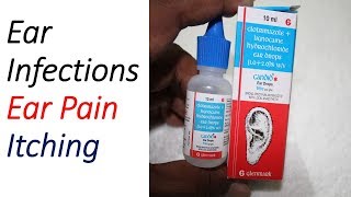 Candid Ear Drops Review  Ear Pain Itching Fungal Infections [upl. by Arezzini]