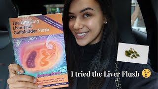 I TRIED LIVER CLEANSE amp STONES CAME OUT 😱  Dina Kaderi Vlog 6 [upl. by Austine]