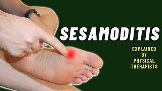 Sesamoiditis explained in detail by Physical Therapists [upl. by Adnamra]