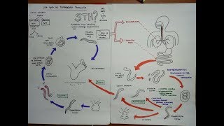 strongyloides stercoralis [upl. by Liauqram]