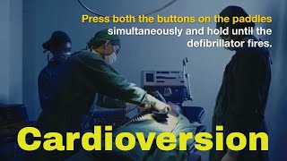 cardioversion How to give Shock with defibrillator and why [upl. by Cheney]