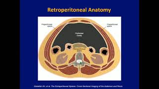 02 Retroperitoneal Spaces Anatomy and Disease Spread [upl. by Branden]