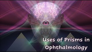 Prisms in Ophthalmology 2  Clinical Uses of Prisms [upl. by Ahseenat90]