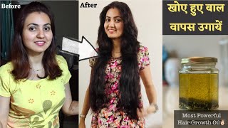 सबसे Powerful Hair Growth Oil to REGROW LOST HAIR  खोये हुए बालों को वापस उगाने सबसे अचूक तरीका [upl. by Ahsemal]