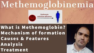 Methemoglobinemia What is methemoglobin amp its FormationTypes Analysis amp Treatment of MetHb [upl. by Doran284]