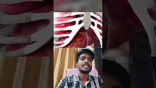 Liver abscess kise kahte hai janiye [upl. by Ecaj904]