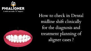 How to check in Dental Midline shift clinically for the diagnosis amp treatment planning of Aligners [upl. by Della]