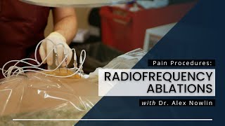 Radiofrequency Ablations What You Should Know [upl. by Wilterdink84]