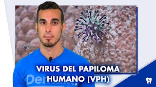 Virus del PAPILOMA HUMANO VPH en la Boca  Síntomas y tratamiento  Shorts [upl. by Strohben194]