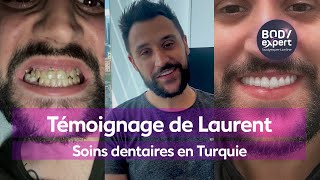 CLINIQUE DENTAIRE TURQUIE  🦷 Témoignage laurent  gummy  7 implants  28 couronnes  BODYEXPERT [upl. by Nerha970]