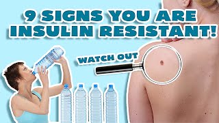 Insulin Resistance Symptoms WHY YOU CANT LOSE WEIGHT [upl. by Shanleigh]