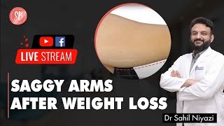 Saggy Arms After Weight Loss  Sagging Arm Treatment  Arm contouring  SB Aesthetics [upl. by Ylrbmik]