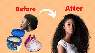 How to use Vaseline and onion to grow hair 2 cm per day Very fast [upl. by Eugenie891]