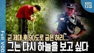 군 복무 중 시작된 허리 통증 병명은 강직성 척추염 굽은 허리로 산 10년 과연 그는 올가을 하늘을 볼 수 있을까  현장기록 병원  KBS 20071030 방송 [upl. by Mirisola367]