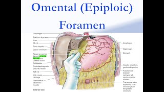 Omental Epiploic Foramen [upl. by Rebme]