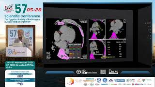 CT Arteriography All What You Need To Know [upl. by Retrop]