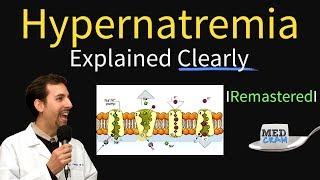 Hypernatremia Explained Types Diagnosis amp Treatment [upl. by Neerual935]