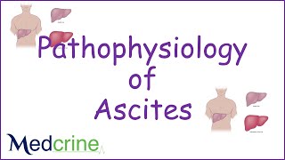 pathophysiology of ascites [upl. by Nilo]