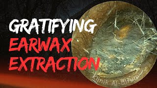 The MOST GRATIFYING Earwax Extraction EVER [upl. by Spiegel819]