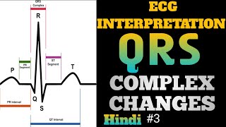 ECG interpretation in hindi  how to read ecg in hindi  QRS Complex Changes interpretation  3 [upl. by Monahon564]