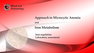 Approach To Microcytic Anemia [upl. by Lered]