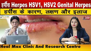 हर्पीस Herpes HSV 1 HSV 2 Genital Herpes का सफल इलाज  Dr Raghav  Heal Max Clinic National Khabar [upl. by Elacim91]