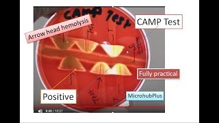 CAMP test CAMP Factor  CAMP Reaction  Microbiology Streptococcus agalactiae [upl. by Sivi]