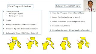 Prognostic factors in Perthes Disease [upl. by Aleakam597]