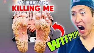 Plastic Surgeon Reacts to MY FEET ARE KILLING ME EXTREME Growths  EXTREME Treatment [upl. by Annovy]