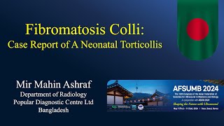 Fibromatosis Colli  Ultrasound  Case 340 [upl. by Duston]