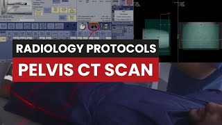 CT Scan of the Pelvis A Protocol Guide for Radiology Techs [upl. by Rabin103]