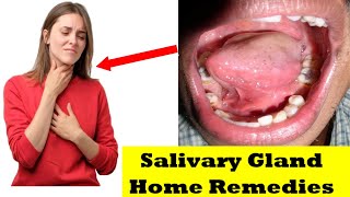 ✅ Salivary glands  salivary gland infection  salivary gland infection home remedies [upl. by Brag612]