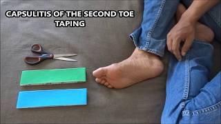 Capsulitis of the second toe taping [upl. by Assillem822]