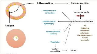 bronchial asthma PTBU [upl. by Mharba]