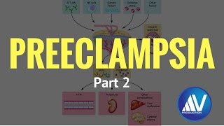 Preeclampsia Part II Pathophysiology [upl. by Rehptsirhc473]