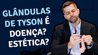 Glândulas de Tyson é doença Estética  Dr Marco Túlio  Urologista e Andrologista [upl. by Cord663]