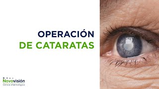 👉‍‍ Operación de cataratas en qué consiste y cómo mejora su visión [upl. by Eiramanel]