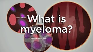 What is myeloma [upl. by Pas]