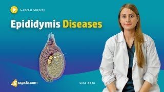 Epididymis Diseases  Surgery Video Lecture  Medical Online Education  VLearning™ [upl. by Naiditch]