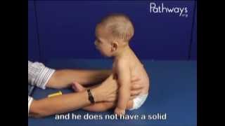 6 Month Olds Babies in Sitting Typical and Atypical Development Comparison [upl. by Roze]