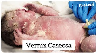 Vernix Caseosa ماده تحمى الطفل اثناء الولادة [upl. by Sirrap]