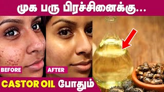 80 बीमारियों का काल है ये तेल  15 Health Benefits of Castor oil Ayurveda  Anurag Rishi [upl. by Mohandis]