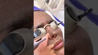 REMOVE PIGMENTATION amp DARK SPOTS FROM FACE NATURALLY  Remove Pigmentation amp Dark Spots short [upl. by Adihahs]