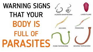 Dont Ignore These Early Symptoms Of Parasites In Your Body [upl. by Lalittah]