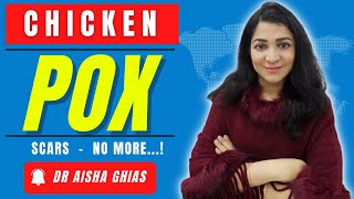 How to Remove ChickenPox Scars at Home  Chicken Pox Scars Treatment by Dr Aisha Ghias [upl. by Enairb506]