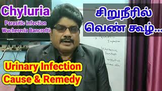 Chyluria  Acupuncture Points  சிறுநீரில் வெண்கூல்  Urinary Infection  சிறுநீர் கழித்தல் சிரமம் [upl. by Eirrek]