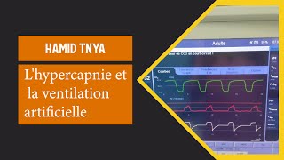 Lhypercapnie et la ventilation artificielle Biomedical engineering [upl. by Jeanna220]